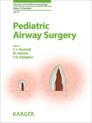 cover image of Pediatric Airway Surgery